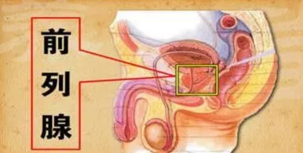 前列腺炎症是怎么引起的,如何治疗?