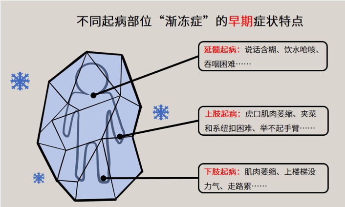 世界渐冻人日 | 心有余而力不足，这种“身不由己”要警惕~