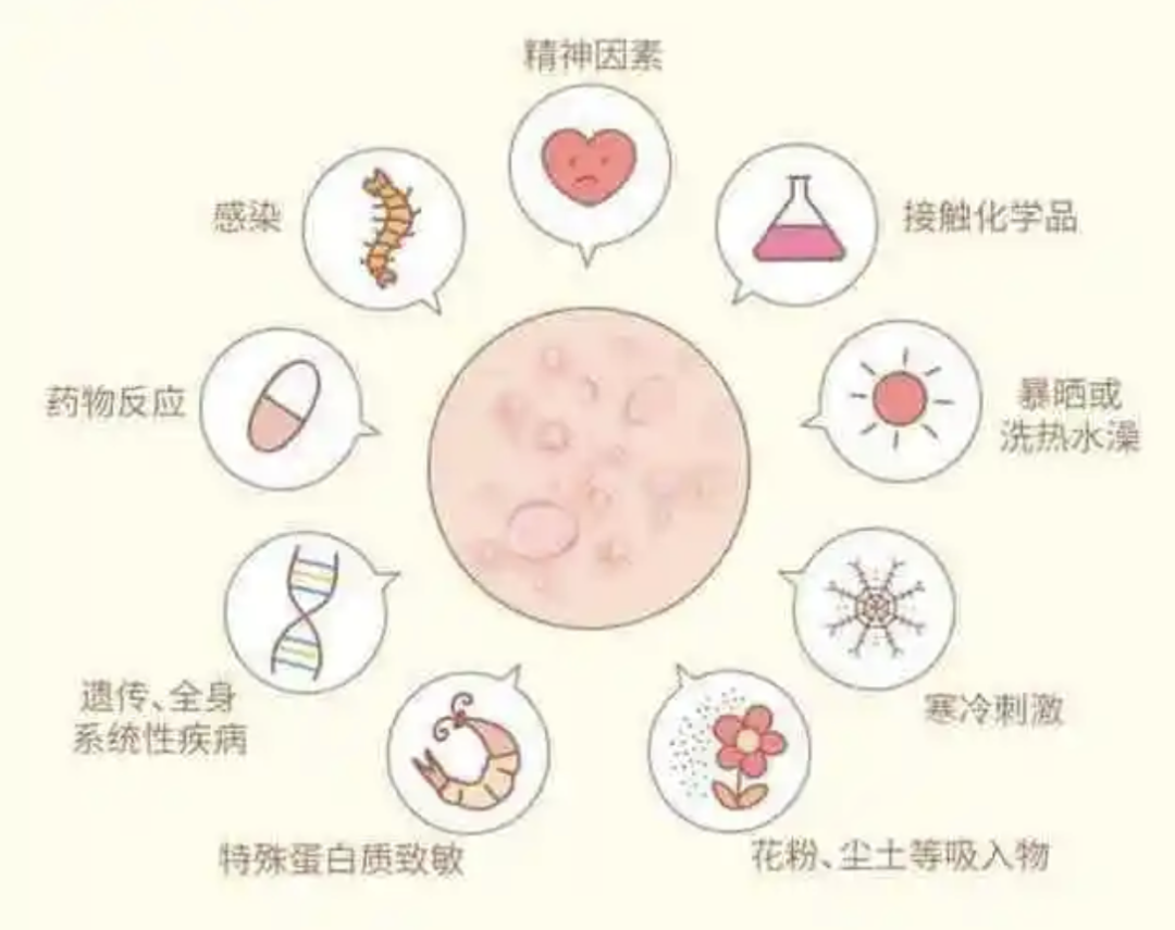 过敏性疾病防治——“过敏星人”超详细地球生存指南